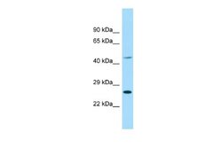 EIF4E1B Rabbit anti-Human, Polyclonal, Novus Biologicals 0.1 mL | Buy Online | Novus Biologicals | Fisher Scientific